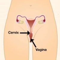 Diagram of cervix and vagina